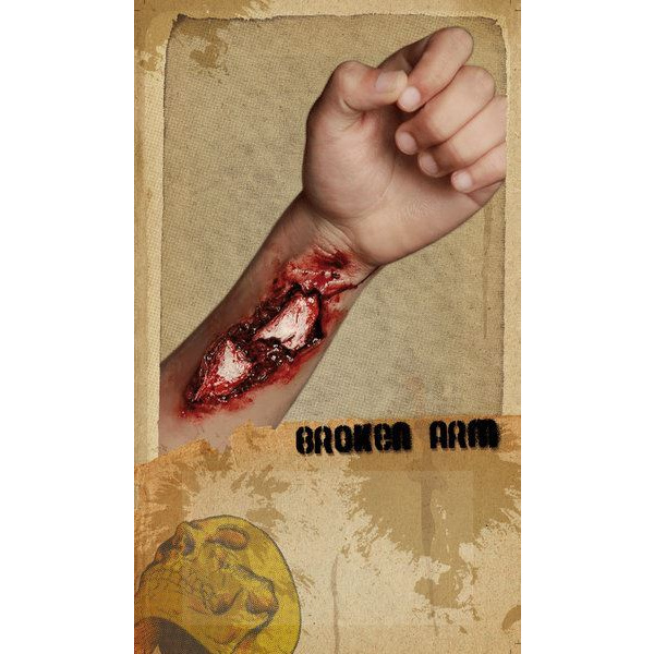 PROSTHETIC WOUNDS BROKEN ARM