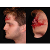 PROSTHETIC WOUNDS HEAD SHOT