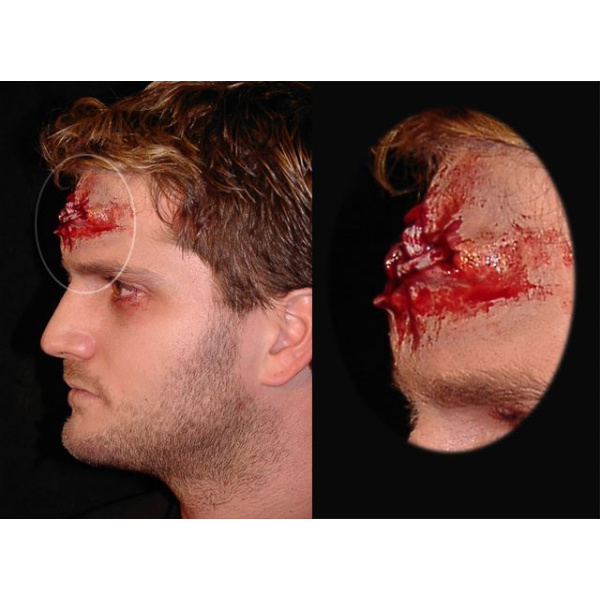 PROSTHETIC WOUNDS HEAD SHOT