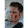 PROSTHETIC WOUNDS OPEN JAW LARGE