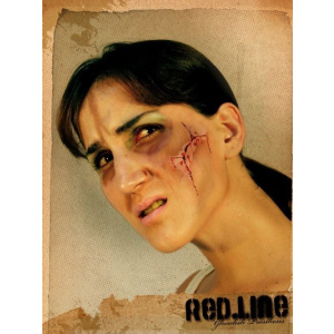 PROSTHETIC WOUNDS RED LINE CHEEK CUT